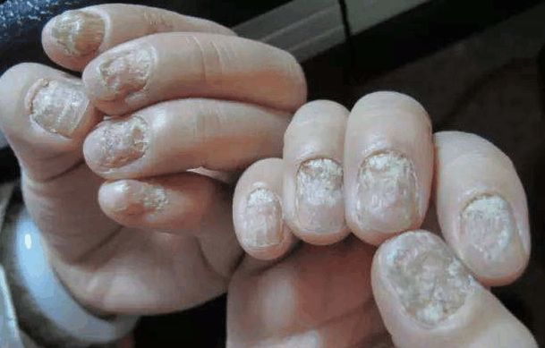 退休医生坦白说：去医院治这10种病，都是浪费钱！你被坑了多少？(图3)